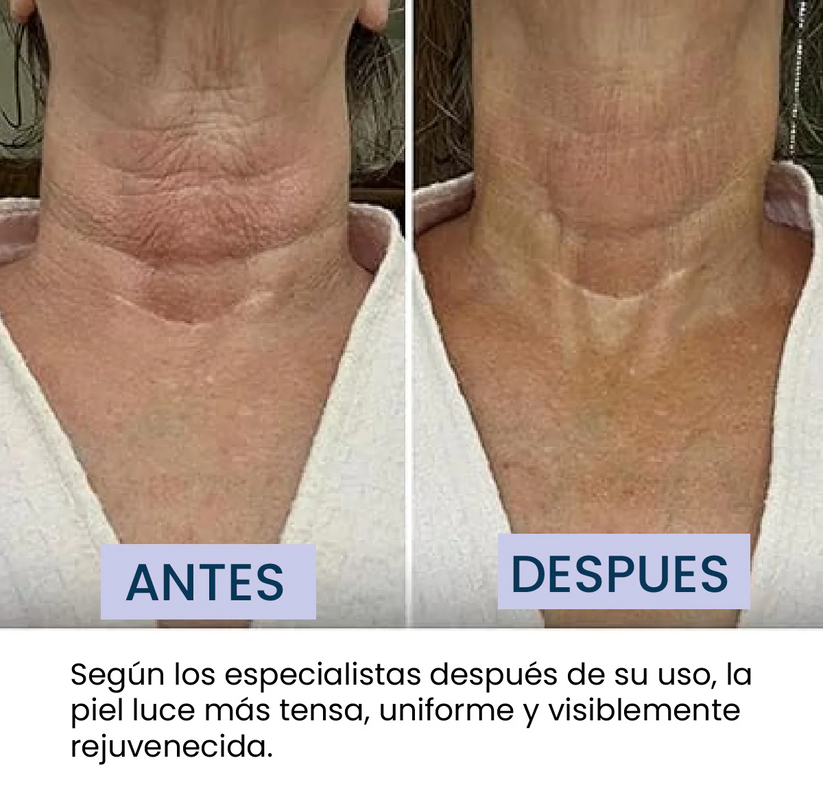 Crema Reafirmante Lifting para el Cuello