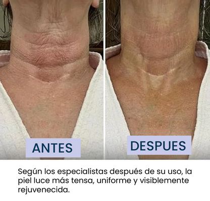 Crema Reafirmante Lifting para el Cuello